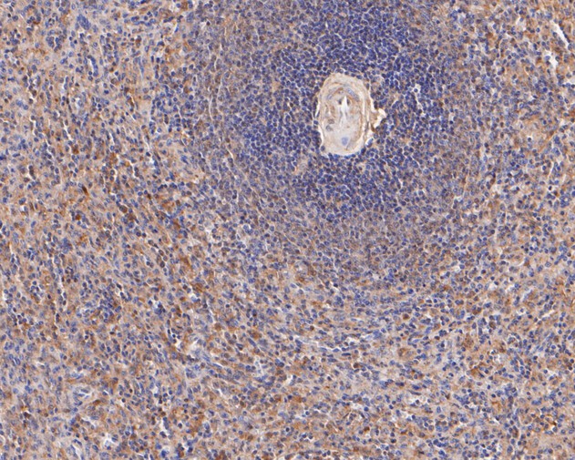 Fig5:; Immunohistochemical analysis of paraffin-embedded human spleen tissue using anti-Themis antibody. The section was pre-treated using heat mediated antigen retrieval with sodium citrate buffer (pH 6.0) for 20 minutes. The tissues were blocked in 5% BSA for 30 minutes at room temperature, washed with ddH; 2; O and PBS, and then probed with the primary antibody ( 1/50) for 30 minutes at room temperature. The detection was performed using an HRP conjugated compact polymer system. DAB was used as the chromogen. Tissues were counterstained with hematoxylin and mounted with DPX.