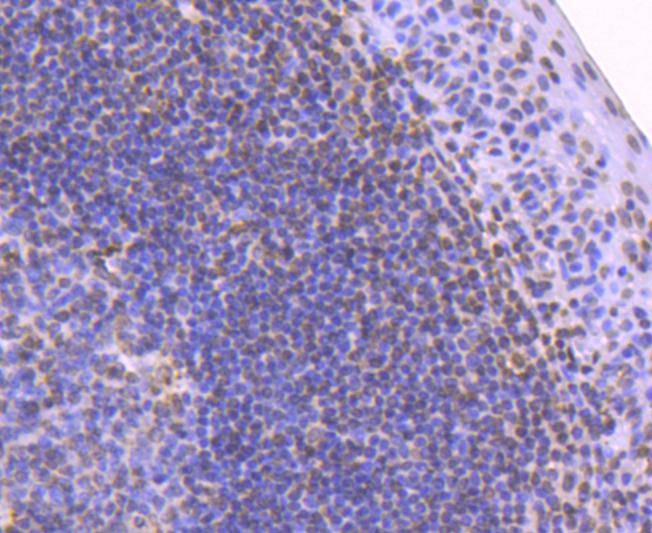 Fig3:; Immunohistochemical analysis of paraffin-embedded human tonsil tissue using anti-Histone H2B antibody. The section was pre-treated using heat mediated antigen retrieval with Tris-EDTA buffer (pH 8.0-8.4) for 20 minutes.The tissues were blocked in 5% BSA for 30 minutes at room temperature, washed with ddH; 2; O and PBS, and then probed with the primary antibody ( 1/50) for 30 minutes at room temperature. The detection was performed using an HRP conjugated compact polymer system. DAB was used as the chromogen. Tissues were counterstained with hematoxylin and mounted with DPX.
