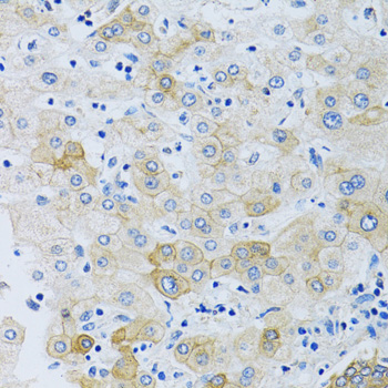 Immunohistochemistry - SLC4A5 Polyclonal Antibody 