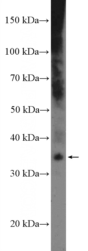 human placenta tissue were subjected to SDS PAGE followed by western blot with Catalog No:112654(MEOX2 Antibody) at dilution of 1:600
