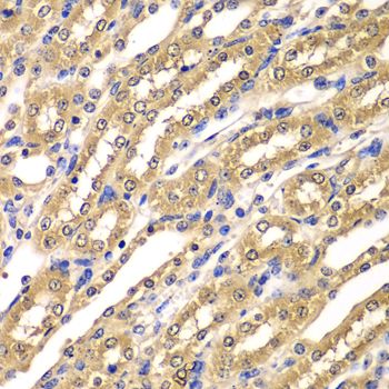 Immunohistochemistry - UBA3 Polyclonal Antibody 
