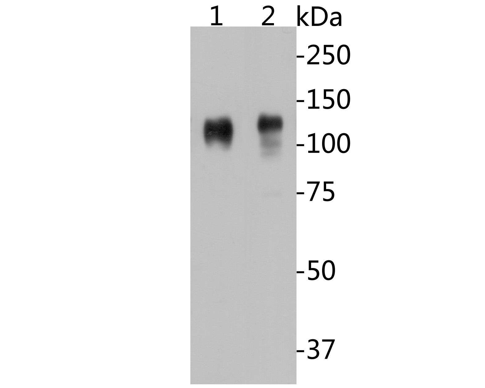 Fig1:; Western blot analysis of CD68 on different lysates. Proteins were transferred to a PVDF membrane and blocked with 5% BSA in PBS for 1 hour at room temperature. The primary antibody ( 1/500) was used in 5% BSA at room temperature for 2 hours. Goat Anti-Mouse IgG - HRP Secondary Antibody (HA1001) at 1:5,000 dilution was used for 1 hour at room temperature.; Positive control:; Lane 1: A431 cell lysate; Lane 2: THP-1 cell lysate