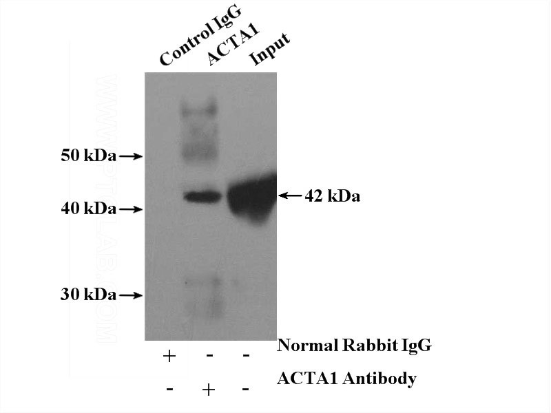 IP Result of anti-ACTA1 (IP:Catalog No:107862, 4ug; Detection:Catalog No:107862 1:4000) with mouse skeletal muscle tissue lysate 2200ug.