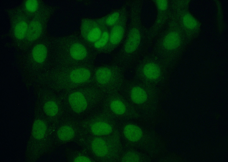 Immunofluorescent analysis of (10% Formaldehyde) fixed MCF-7 cells using Catalog No:115807(STUB1 Antibody) at dilution of 1:50 and Alexa Fluor 488-congugated AffiniPure Goat Anti-Rabbit IgG(H+L)