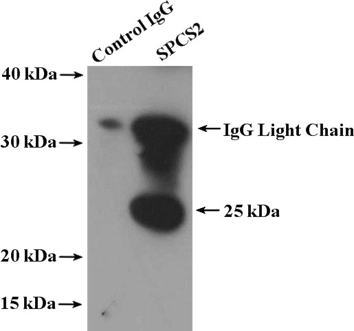 IP Result of anti-SPCS2 (IP:Catalog No:115559, 4ug; Detection:Catalog No:115559 1:500) with mouse colon tissue lysate 4000ug.