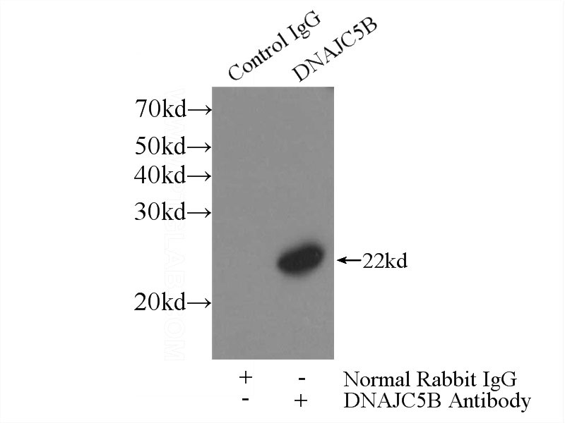 IP Result of anti-DNAJC5B (IP:Catalog No:109950, 3ug; Detection:Catalog No:109950 1:1500) with mouse testis tissue lysate 4000ug.