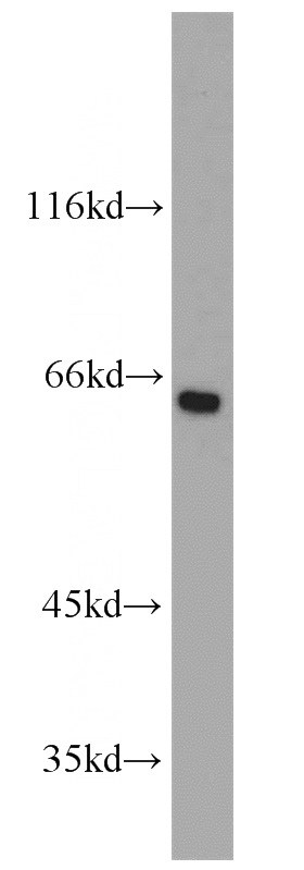 HEK-293 cells were subjected to SDS PAGE followed by western blot with Catalog No:113988(PODXL antibody) at dilution of 1:500