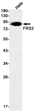 Western blot detection of FRS2 in Hela cell lysates using FRS2 Rabbit mAb(1:1000 diluted).Predicted band size:57kDa.Observed band size:57kDa.