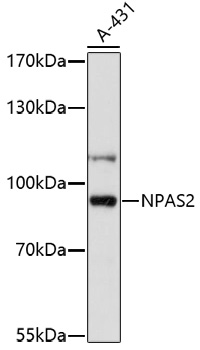 Western blot - NPAS2 Polyclonal Antibody 