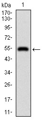 Fig1: Western blot analysis of DIS3L2 on human DIS3L2 recombinant protein using anti-DIS3L2 antibody at 1/1,000 dilution.