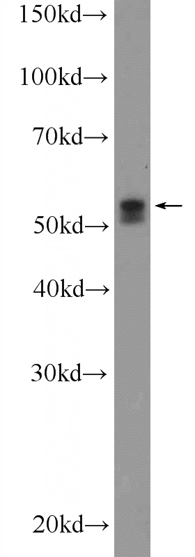 COLO 320 cells were subjected to SDS PAGE followed by western blot with Catalog No:116321(TRIM6 Antibody) at dilution of 1:1000