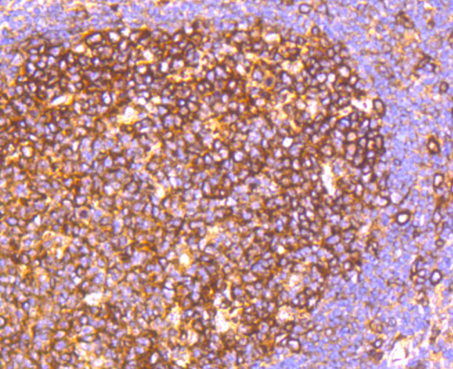 Immunohistochemistry - HAPLN1 Monoclonal Antibody 