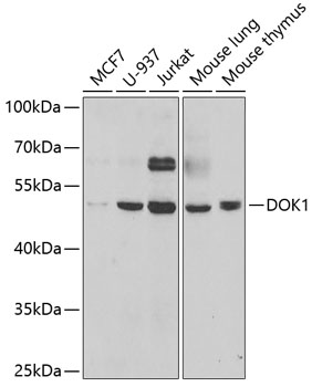Western blot - DOK1 Polyclonal Antibody 