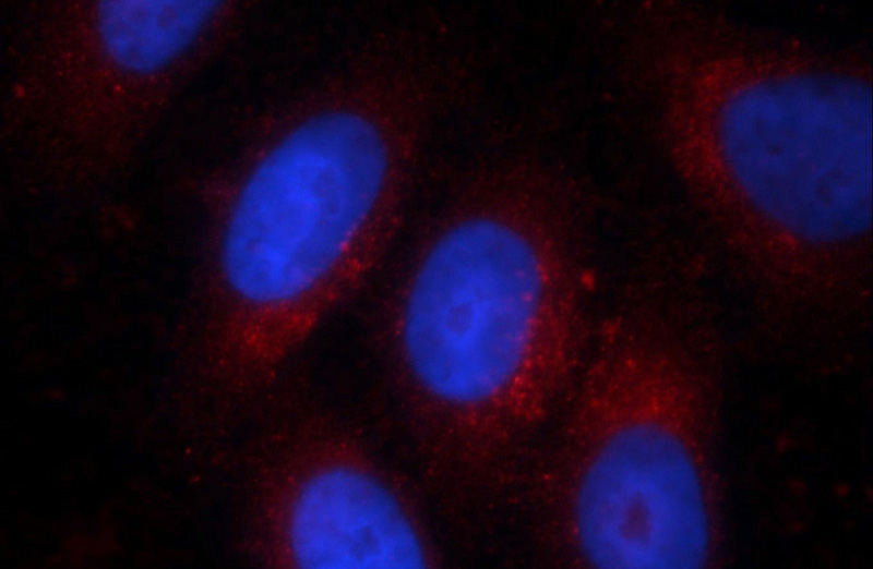 Immunofluorescent analysis of HepG2 cells using Catalog No:107577(GLA Antibody) at dilution of 1:50 and Rhodamine-Goat anti-Mouse IgG