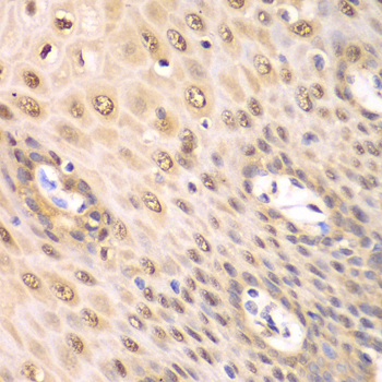 Immunohistochemistry - PSMA2 Polyclonal Antibody 
