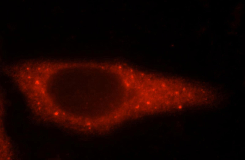Immunofluorescent analysis of HepG2 cells, using GARS antibody Catalog No:110867 at 1:25 dilution and Rhodamine-labeled goat anti-rabbit IgG (red).