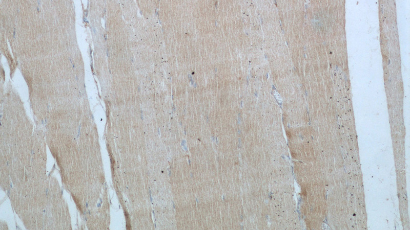 Immunohistochemical of paraffin-embedded human skeletal muscle using Catalog No:113404(NUBP2 antibody) at dilution of 1:50 (under 10x lens)