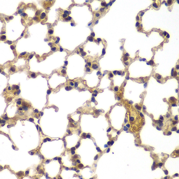 Immunohistochemistry - ASPSCR1 Polyclonal Antibody 