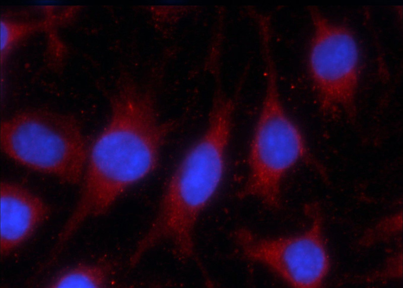 Immunofluorescent analysis of C6 cells using Catalog No:107407(LONP1 Antibody) at dilution of 1:25 and Rhodamine-Goat anti-Mouse IgG