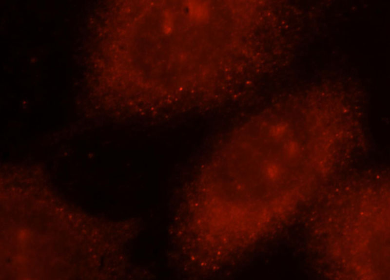 Immunofluorescent analysis of Hela cells, using NADK antibody Catalog No:113014 at 1:25 dilution and Rhodamine-labeled goat anti-rabbit IgG (red).