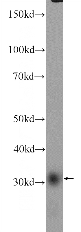 mouse testis tissue were subjected to SDS PAGE followed by western blot with Catalog No:115668(SRD5A1 Antibody) at dilution of 1:1000