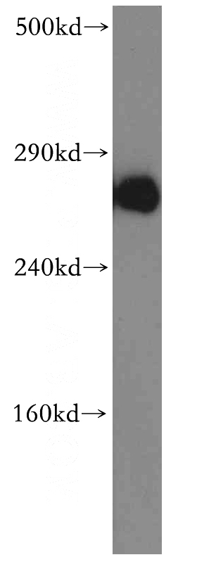 mouse brain tissue were subjected to SDS PAGE followed by western blot with Catalog No:111960(ITPR1-specific antibody) at dilution of 1:300