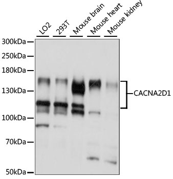 Western blot - CACNA2D1 Polyclonal Antibody 