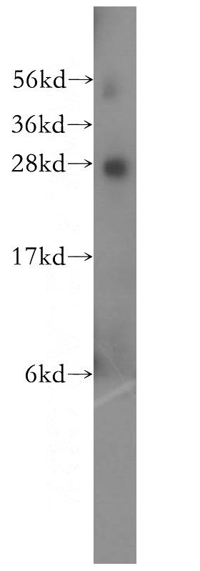 human brain tissue were subjected to SDS PAGE followed by western blot with Catalog No:114501(RABL2B antibody) at dilution of 1:500