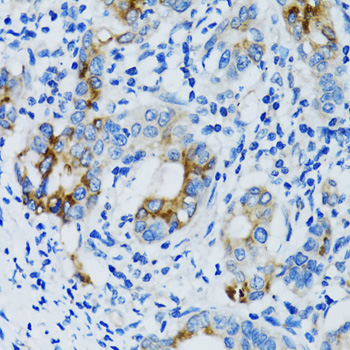 Immunohistochemistry - MMP7 Polyclonal Antibody 