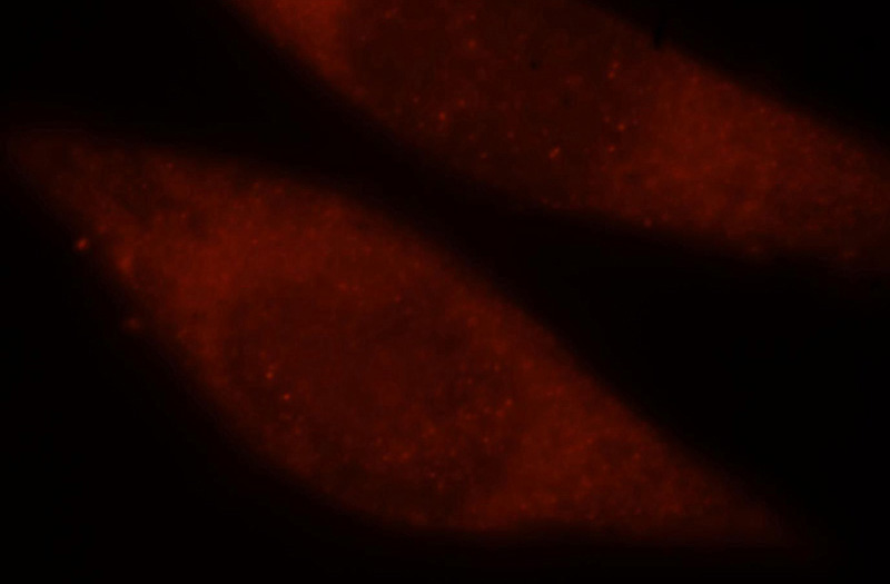 Immunofluorescent analysis of Hela cells, using TARBP2 antibody Catalog No:116352 at 1:25 dilution and Rhodamine-labeled goat anti-rabbit IgG (red).