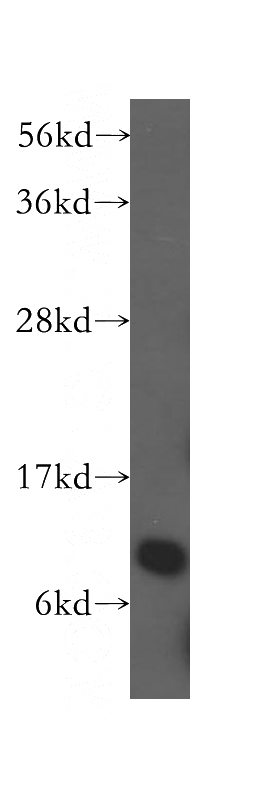 human brain tissue were subjected to SDS PAGE followed by western blot with Catalog No:113061(NDUFA5 antibody) at dilution of 1:500