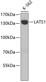Western blot - LATS1 Polyclonal Antibody 