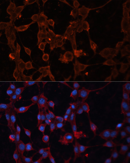 Immunofluorescence - SLC25A27 Polyclonal Antibody 