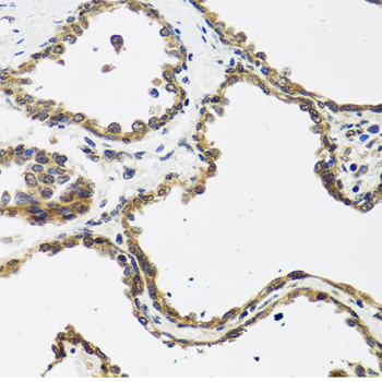 Immunohistochemistry - CALCB Polyclonal Antibody 