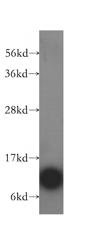 HeLa cells were subjected to SDS PAGE followed by western blot with Catalog No:108324(ATPIF1 antibody) at dilution of 1:500