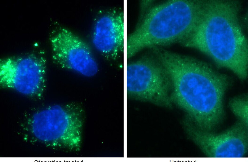 Immunofluorescent analysis of (-20oc Ethanol) fixed HepG2 cells using Catalog No:113556(P62;SQSTM1 Antibody) at dilution of 1:100 and Alexa Fluor 488-congugated AffiniPure Goat Anti-Rabbit IgG(H+L)