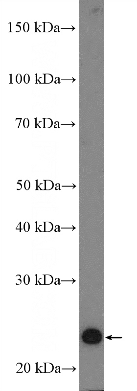 mouse heart tissue were subjected to SDS PAGE followed by western blot with Catalog No:109560(CRIP2 Antibody) at dilution of 1:1500