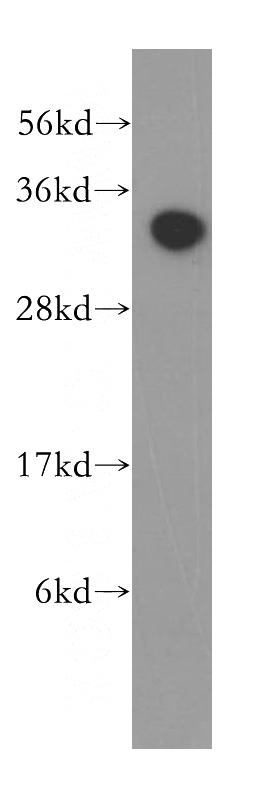 human liver tissue were subjected to SDS PAGE followed by western blot with Catalog No:111328(HAAO antibody) at dilution of 1:300