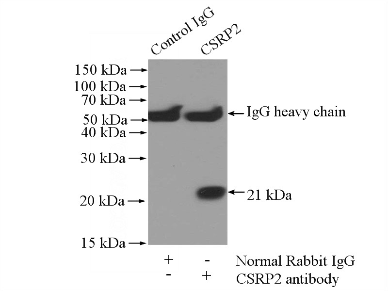 IP Result of anti-CSRP2 (IP:Catalog No:109609, 4ug; Detection:Catalog No:109609 1:1000) with mouse liver tissue lysate 4000ug.