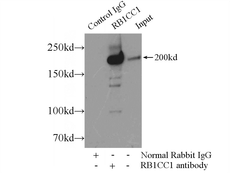 IP Result of anti-RB1CC1 (IP:Catalog No:114490, 5ug; Detection:Catalog No:114490 1:500) with HEK-293 cells lysate 2500ug.