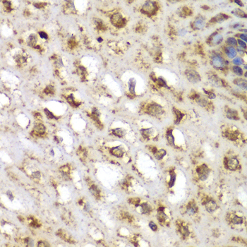 Immunohistochemistry - SGK1 Polyclonal Antibody 