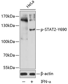 Western blot - Phospho-STAT2-Y690 pAb 
