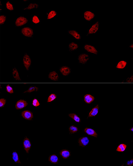 Immunofluorescence - ASPSCR1 Polyclonal Antibody 