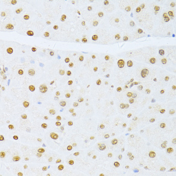 Immunohistochemistry - ETV1 Polyclonal Antibody 