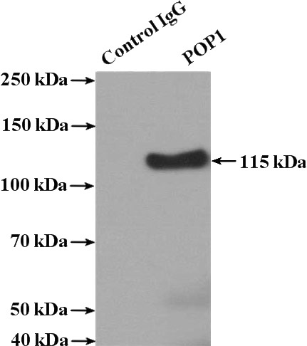 IP Result of anti-POP1 (IP:Catalog No:114060, 4ug; Detection:Catalog No:114060 1:500) with HeLa cells lysate 2400ug.