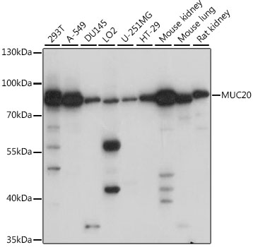 Western blot - MUC20 Polyclonal Antibody 
