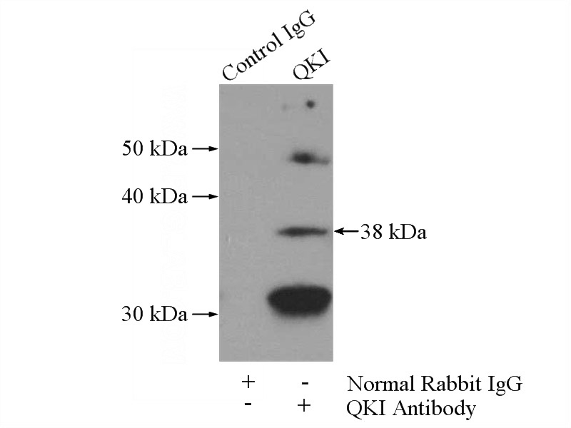 IP Result of anti-QKI (IP:Catalog No:114367, 4ug; Detection:Catalog No:114367 1:400) with K-562 cells lysate 3600ug.