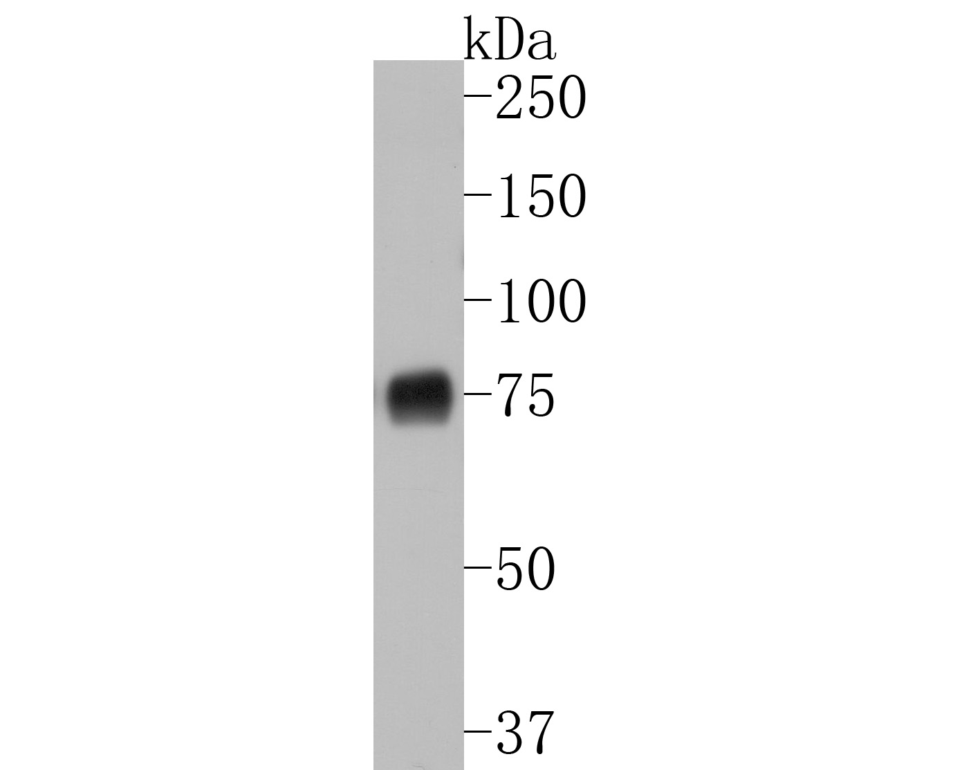 Fig2:; Western blot analysis of p75 NGF Receptor on PC-12 cell lysates. Proteins were transferred to a PVDF membrane and blocked with 5% BSA in PBS for 1 hour at room temperature. The primary antibody ( 1/500) was used in 5% BSA at room temperature for 2 hours. Goat Anti-Rabbit IgG - HRP Secondary Antibody (HA1001) at 1:200,000 dilution was used for 1 hour at room temperature.