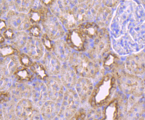 Fig3: Immunohistochemical analysis of paraffin-embedded rat kidney tissue using anti-MAL antibody. Counter stained with hematoxylin.