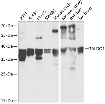 Western blot - TALDO1 Polyclonal Antibody 